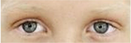 Mi Ojos